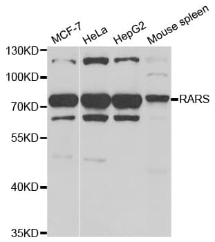 Polyclonal Rabbit anti-Human RARS Antibody (IHC, IF, WB)