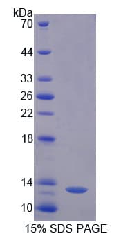 Pig AOC1 Protein (Recombinant His)