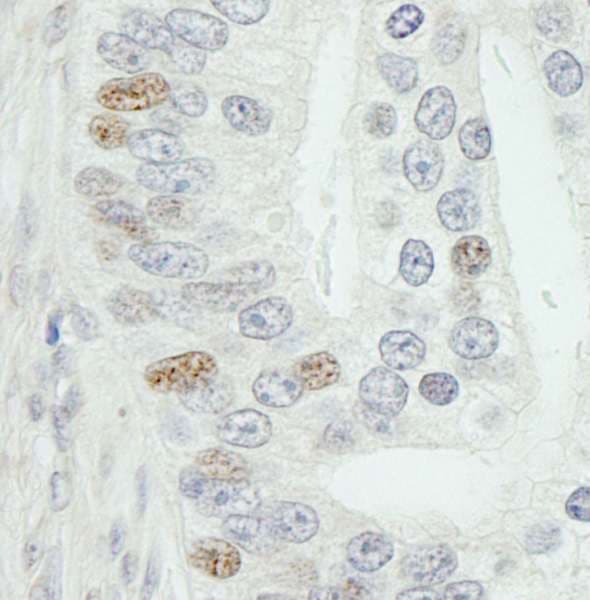 MED18 Antibody (aa150-C-term)