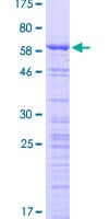 Human CCDC137 Protein (Recombinant GST)