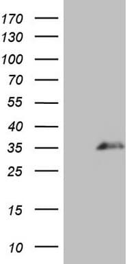 Monoclonal Mouse anti-Human SPANXN3 Antibody (clone OTI4B1, WB)