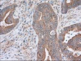 SNX9 / WISP Antibody (clone OTI2E1)