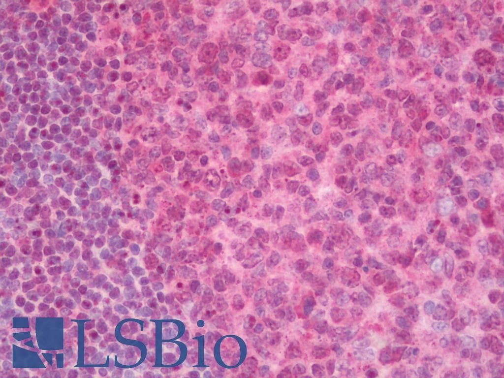 IHC-plus™ PHF5A / INI Antibody