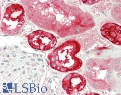 IHC-plus™ Polyclonal Rabbit anti-Human CA12 / Carbonic Anhydrase XII Antibody (aa25-301, IHC, WB)