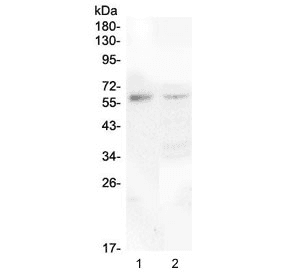 CSF1 / MCSF Antibody