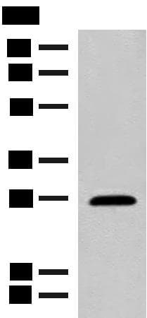 GCAP2 / GUCA1B Antibody
