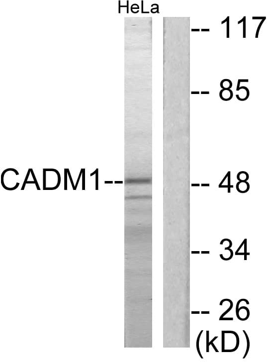 PathPlus™ SYNCAM / CADM1 Antibody (aa393-442)