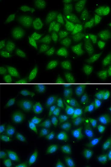 Polyclonal Rabbit anti-Human LELP1 Antibody (IHC, IF, WB)