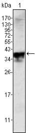 AR / Androgen Receptor Antibody (clone 2H8)