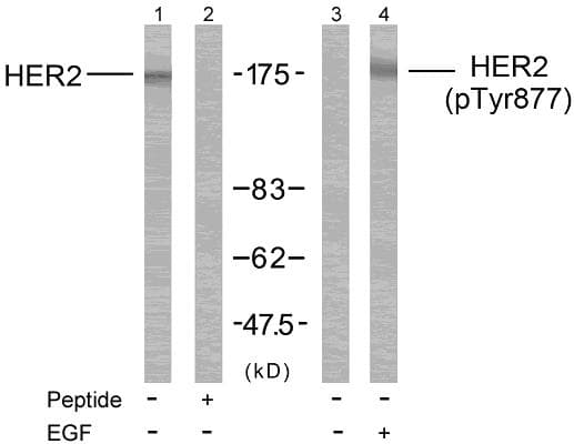 ERBB2 / HER2 Antibody (phospho-Tyr877)