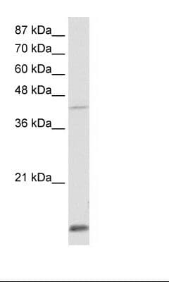 Polyclonal Rabbit anti-Human MKX Antibody (aa191-240, IHC, WB)