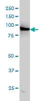 Monoclonal Mouse anti-Human P3H1 / LEPRE1 Antibody (clone 3C7, IHC, IF, WB)