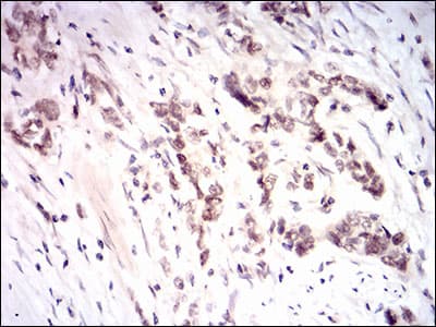 Monoclonal Mouse anti-Human NFE2L2 / NRF2 Antibody (clone 1A6G6, aa356-589, IHC, WB)