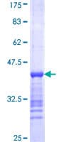 Human GRIP1 Protein (Recombinant GST, N-terminus)