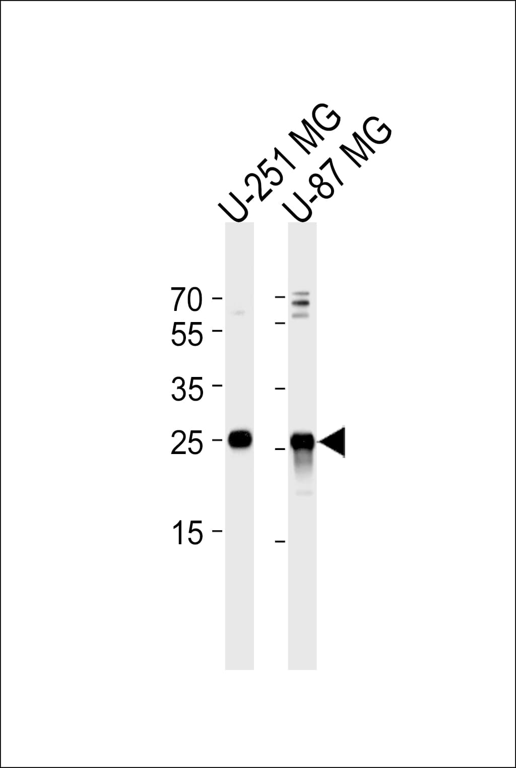VTI1A Antibody (aa140-169)