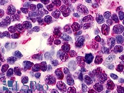 PathPlus™ Polyclonal Rabbit anti-Human RAIG2 / GPRC5B Antibody (C-Terminus, IHC)