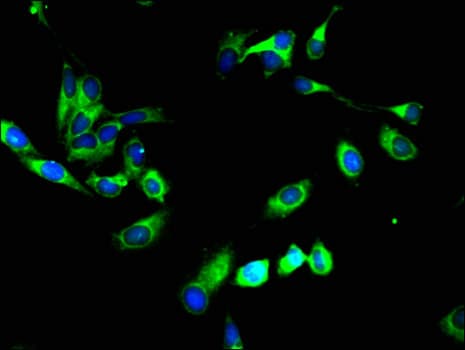 SYVN1 / HRD1 Antibody