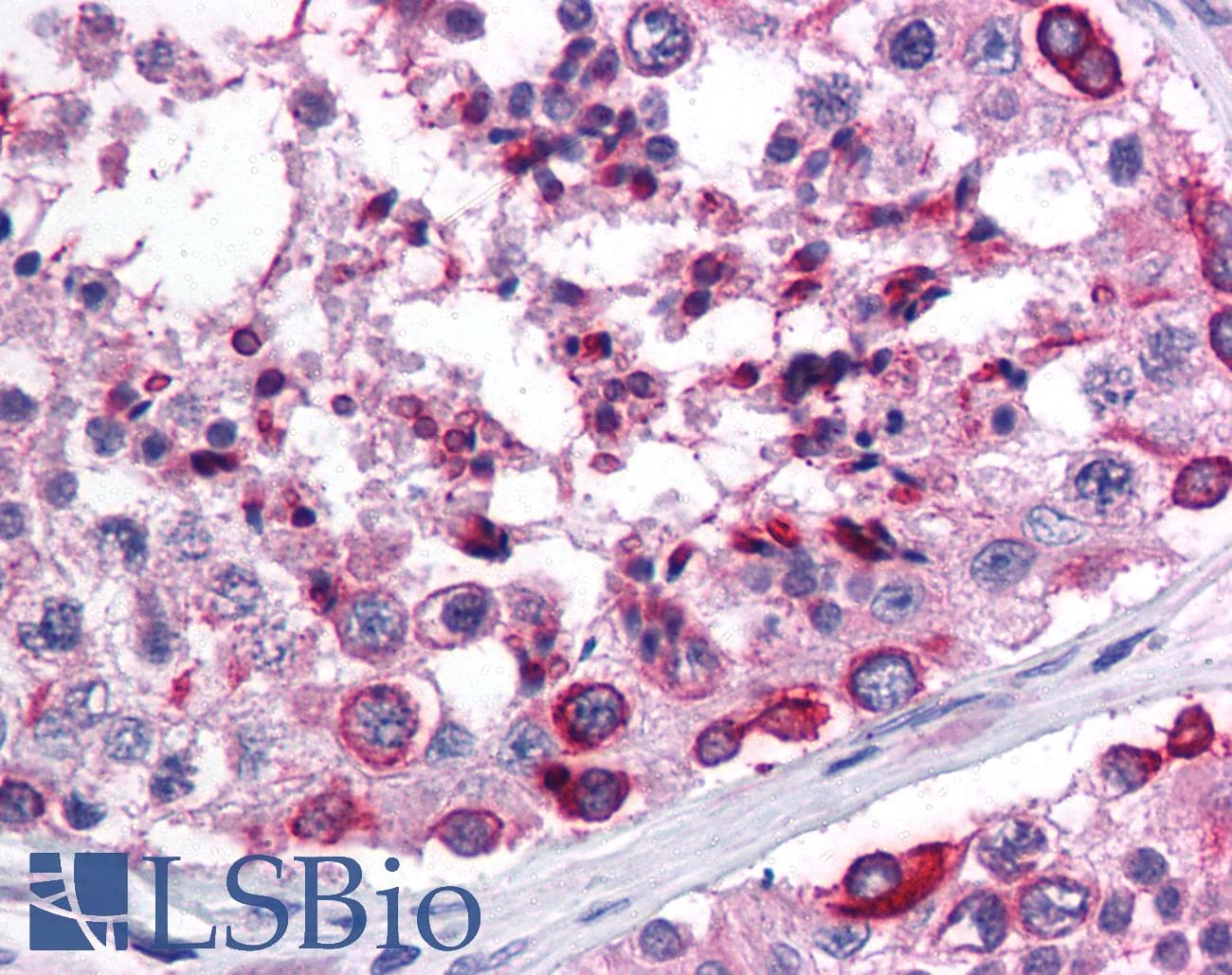 APOBEC3G / CEM15 Antibody (aa51-100)