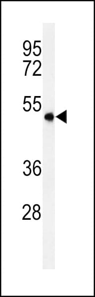 Polyclonal Rabbit anti-Human SMPDL3A Antibody (aa321-349, IHC, WB)