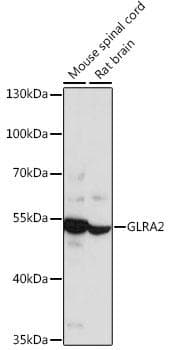 Polyclonal Rabbit anti-Human GLRA2 Antibody (WB)