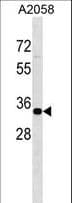 Polyclonal Rabbit anti-Human ZNF570 Antibody (aa169-198, WB)