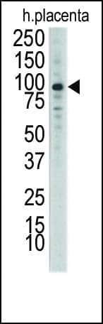 Polyclonal Rabbit anti-Human NEP / DDR1 Antibody (aa17-47, IHC, WB)