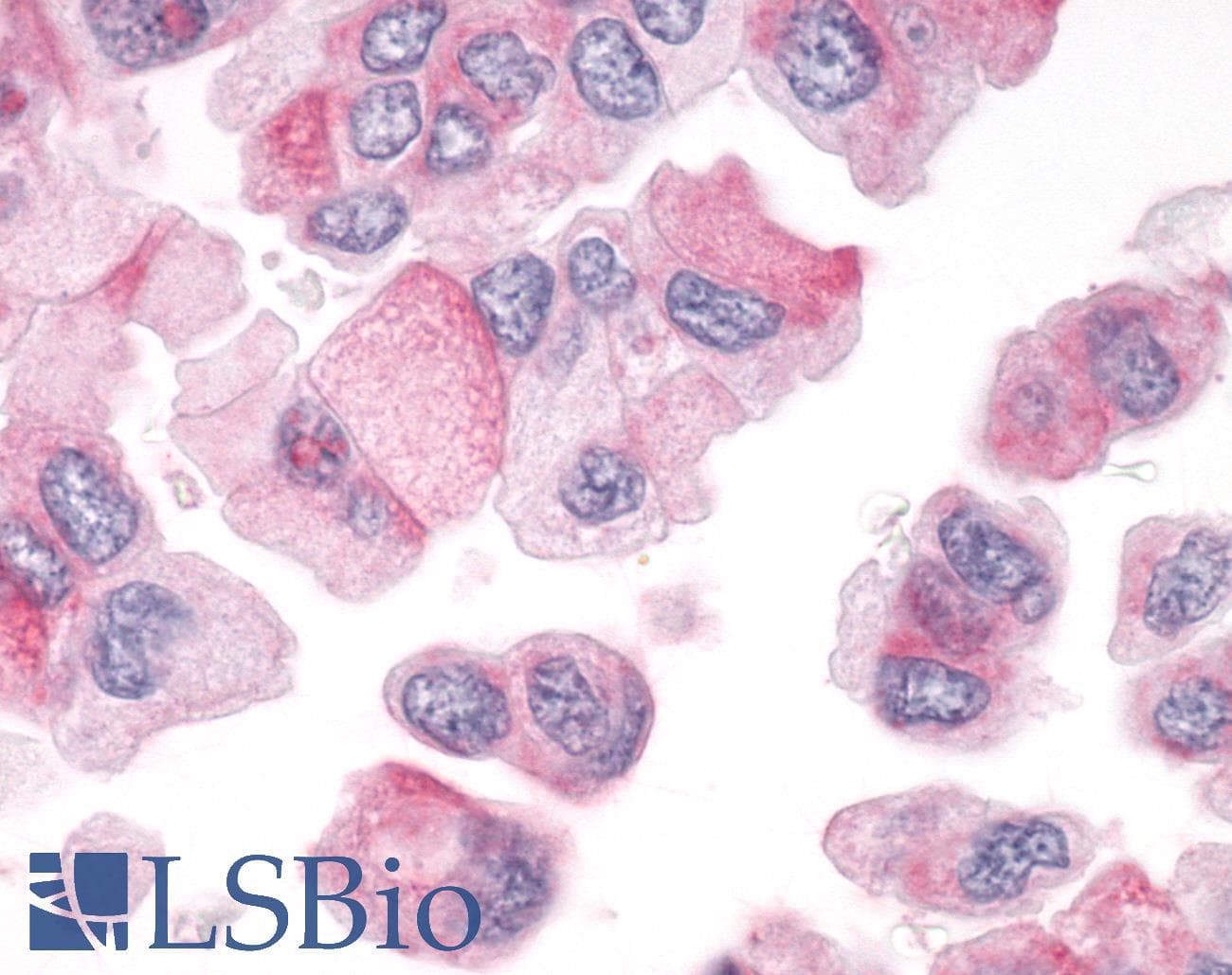 PathPlus™ Polyclonal Rabbit anti-Human PTPRA / RPTP-Alpha Antibody (Cytoplasmic Domain, IHC)