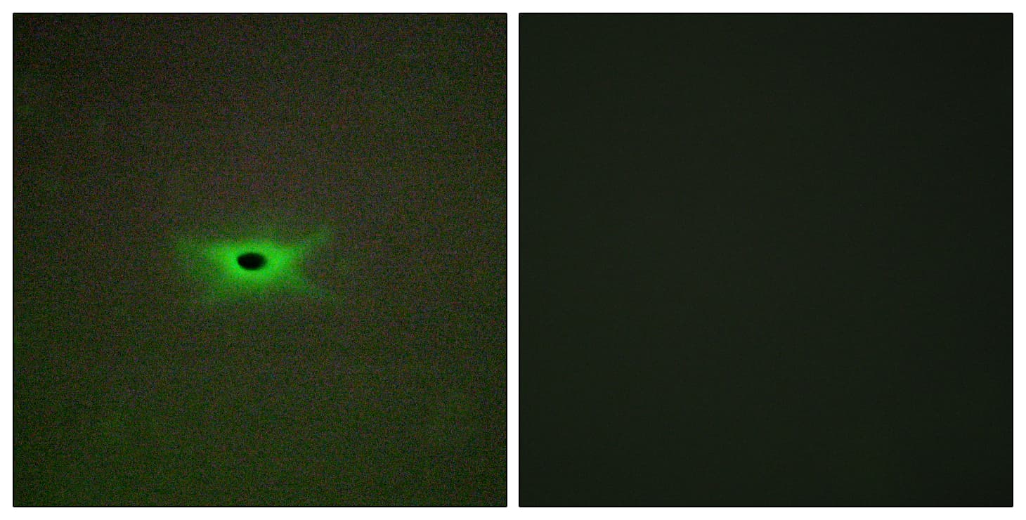 Polyclonal Rabbit anti-Human PRKAG2 / AMPK Gamma 2 Antibody (aa1-50, IHC, IF)