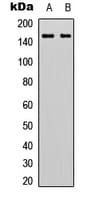 IHC-plus™ ADGRF5 / GPR116 Antibody (N-Terminus)
