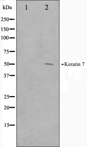 KRT7 / CK7 / Cytokeratin 7 Antibody