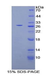 Human PLCG1 Protein (Recombinant His-T7)