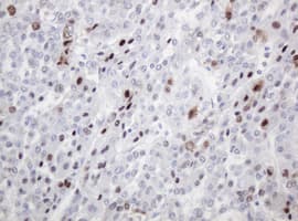 PCNA Antibody (clone OTI4G3)