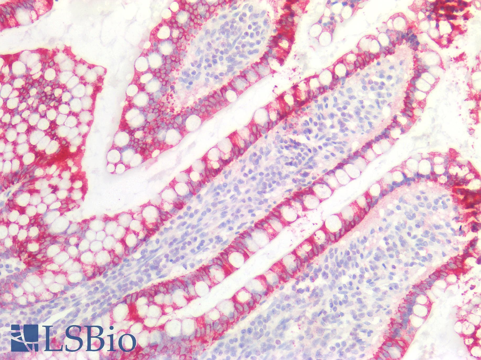 PathPlus™ KRT5 / CK5 / Cytokeratin 5 Antibody