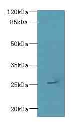 Polyclonal Rabbit anti-Human ARPIN / C15orf38 Antibody (IHC, WB)
