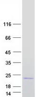 Human LTC4S / LTC4 Synthase Protein (Recombinant Myc-DDK (Flag))