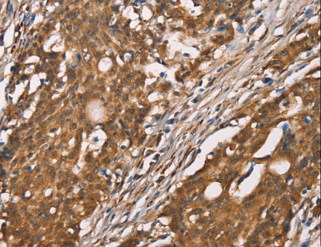 DICER1 / Dicer Antibody