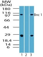 BNC1 / Basonuclin Antibody (aa330-380)