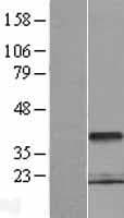 PCGF6 Protein (Over-Expression Lysate Myc-DDK (Flag))