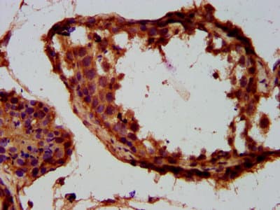 Polyclonal Rabbit anti-Human TUSC3 Antibody (IHC, WB)