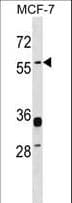 Polyclonal Rabbit anti-Human ERVWE1 / HERV / Syncytin Antibody (aa493-521, WB)