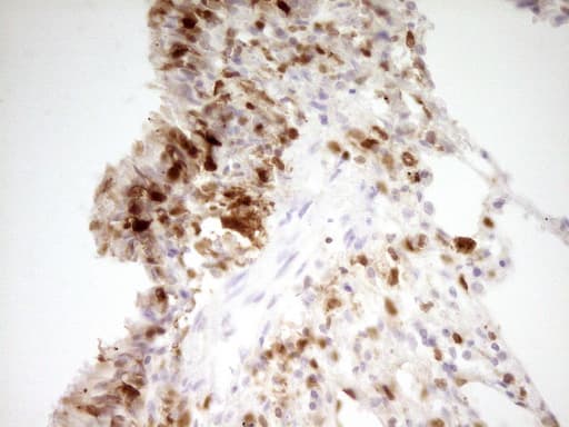 IHC-plus™ LGALS9 / Galectin 9 Antibody (clone 2A4)