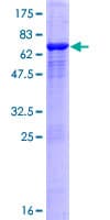 Human ASCC1 Protein (Recombinant GST)