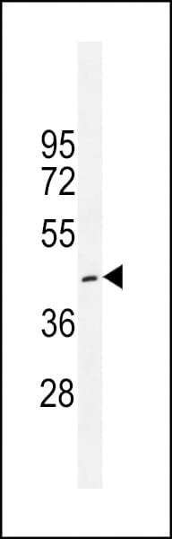 Polyclonal Rabbit anti-Human CRFR1 / CRHR1 Antibody (aa88-119, WB)