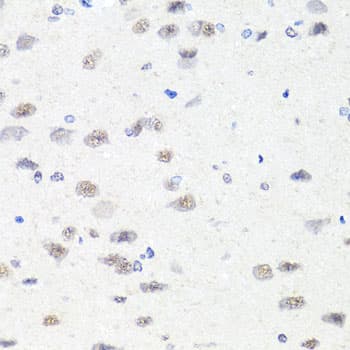 Polyclonal Rabbit anti-Human CHD1 Antibody (IHC, WB)