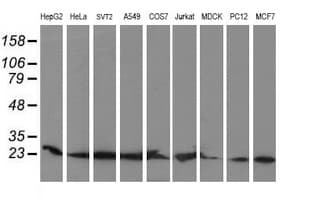 COMMD1 Antibody (clone OTI1F2)