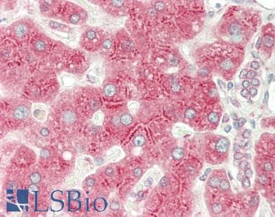 IHC-plus™ Polyclonal Rabbit anti-Human SIRT3 / Sirtuin 3 Antibody (IHC, WB)