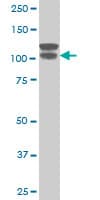 IHC-plus™ ARVCF Antibody (clone 5D2)