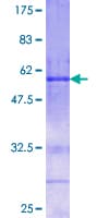 Human FSTL3 / FLRG Protein (Recombinant GST)