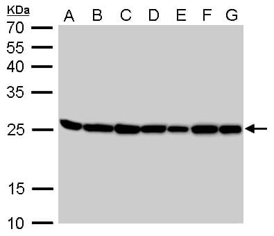 TPI1 / TPI Antibody (aa187-249)