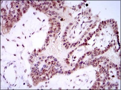 SPIB Antibody (Amino Acid: 200-252, clone 4G5)